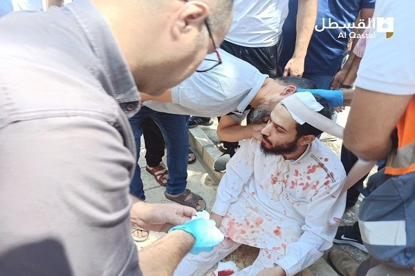 8 إصابات في اعتداء الإحتلال على المصلين في الأقصى + صور و فيديو