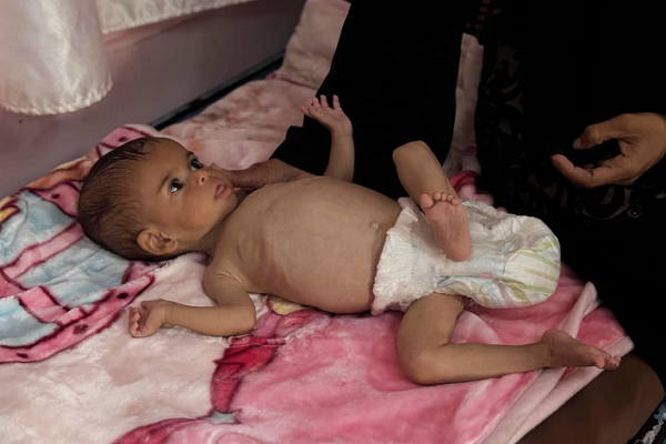 The situation in the Gaza Strip is catastrophic, especially for children, amid the Israeli war and siege.