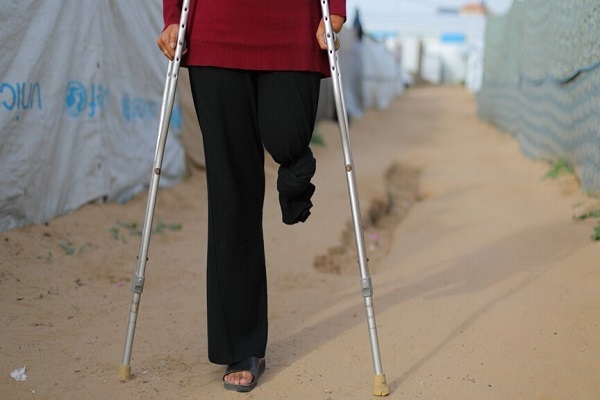 The UN warned on May 4, 2026, that one in five amputees in the Gaza Strip is a child, as a critical shortage of prosthetic specialists and restricted entry of materials leave thousands without adequate care.