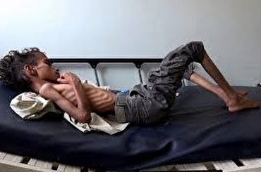 ONU: 13 millones de yemeníes en riesgo de morir de hambre