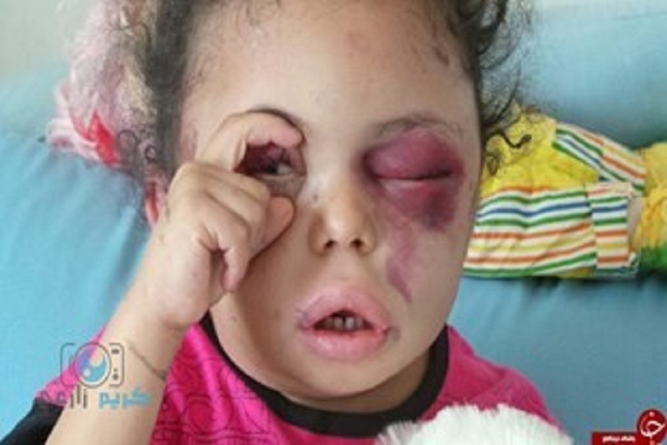 حکومت اسلامی موظف به حمایت از مظلومان در عرصه بین‌المللی است