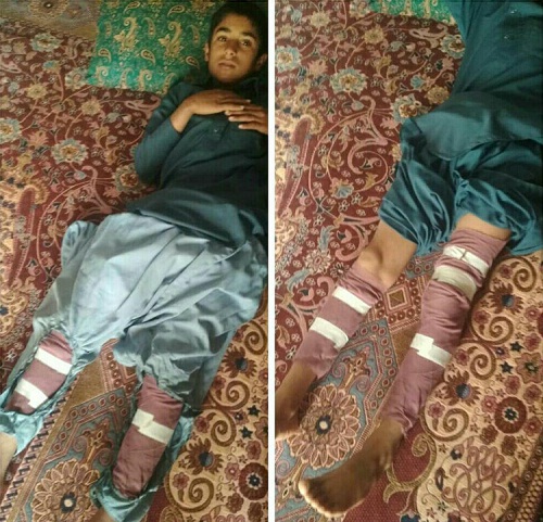 چراغ نفتی بار دیگر قربانی گرفت چراغ نفتی بار دیگر قربانی گرفت