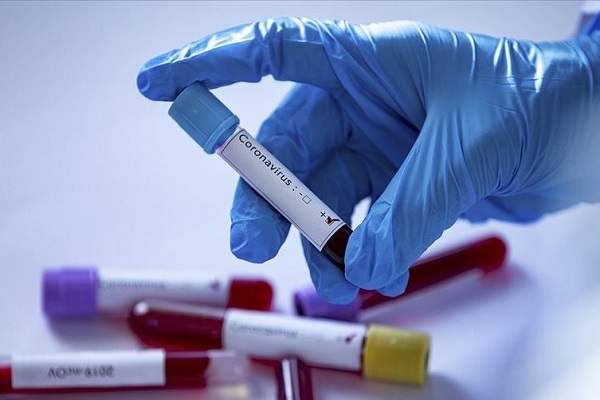 از درخواست بودجه 5 تریلیون دلاری تا هشدار با تابوت در خیابانهای فیلیپین از درخواست بودجه 5 تریلیون دلاری تا هشدار با تابوت در خیابانهای فیلیپین