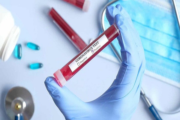 سطح حساسیت&zwnj;ها نسبت به ویروس کرونا در اردبیل پایین آمده است