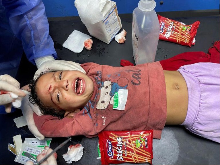 قرآن؛ تسکین آلام مجروحان غزه در عمل‌های بدون بیهوشی + فیلم