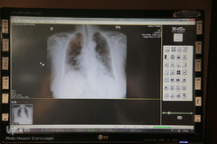 بخش ویژه بیماران کرونا در بیمارستان علی ابن ابیطالب (ع) قم