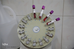 بخش ویژه بیماران کرونا در بیمارستان علی ابن ابیطالب (ع) قم