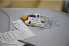 پلاسما درمانی، راهکاری برای بهبود بیماران کرونایی