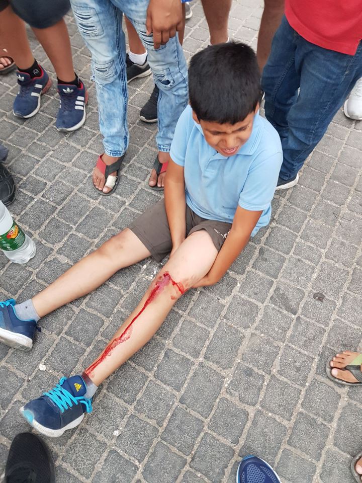 Gerusalemme, colono israeliano investe deliberatamente bimbi palestinesi Gerusalemme, colono israeliano investe deliberatamente bimbi palestinesi