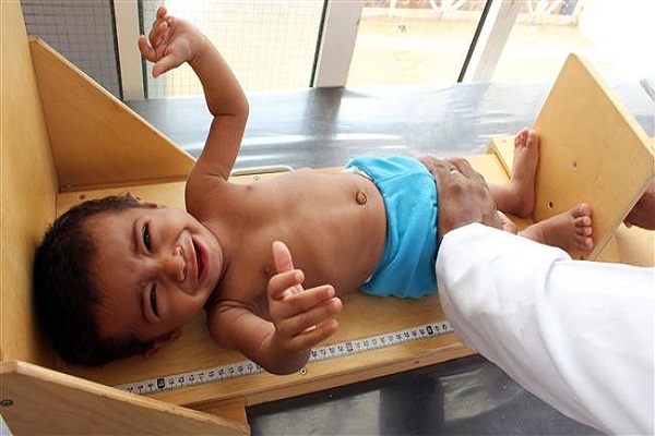 Yemen: ONU avverte circa epidemia inarrestabile a Hudaydah