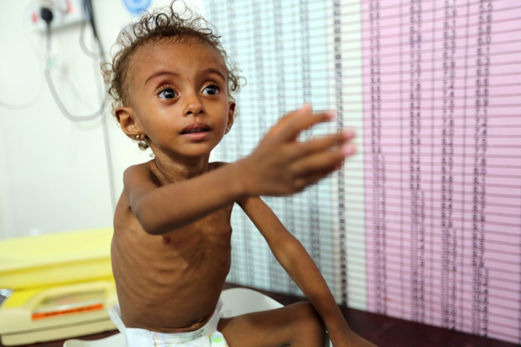 Croce Rossa: milioni di persone in Yemen soffrono di insicurezza alimentare a causa dell’aggressione saudita