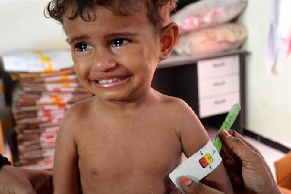 Yemen, decine di bambini uccisi in due mesi Yemen, decine di bambini uccisi in due mesi
