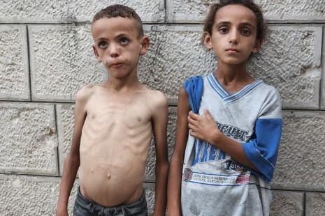 Il bilancio delle vittime della fame sale a 303, inclusi 117 bambini