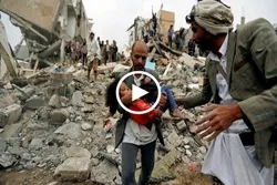 ملګري ملتونه: يمن د نړۍ له ټولو بد انساني بحران سره مخامخ دے