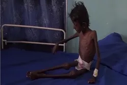 اقوام متحدہ: چار ملین یمنی آوارہ ہوچکے ہیں