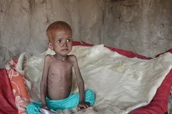 WFP Warns of Looming Famine in Yemen amid Saudi-Led Aggression