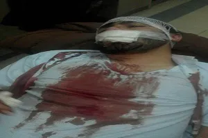 دلجویی رئیس دانشگاه آزاد همدان از دانشجوی بسیجی