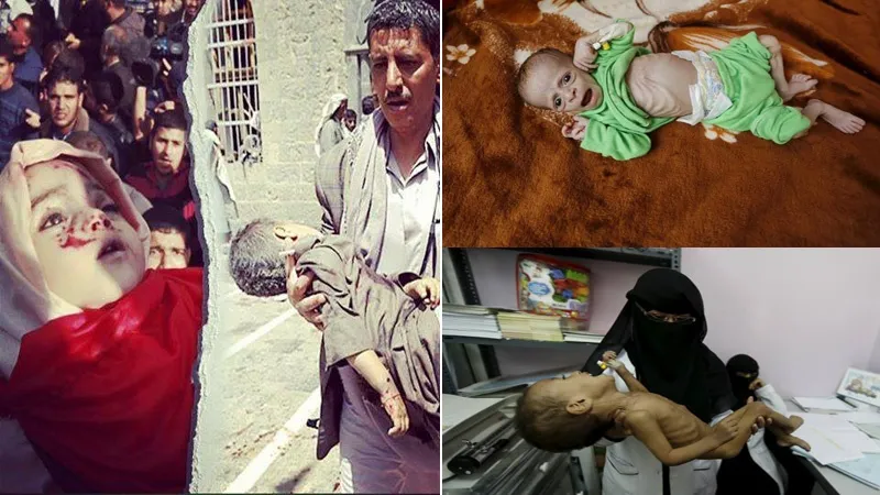 Uungaji Mkono wa Marekani kwa jinai za Saudia  nchini Yemen ni nembo ya haki za binadamu za Shetani Mkubwa