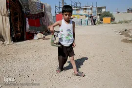 متین کودک بیمار که به همراه خانواده مستاجر خود در کانکس های اهدایی در محله زعفران سرپل ذهاب زندگی میکند 