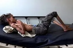 13 millions de Yéménites risquent de mourir de faim, selon l’ONU