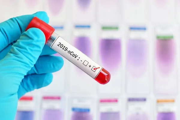 Afrika'da COVID-19 vakaları 40 bini geçti