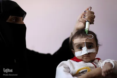 سوءتغذیه کودکان «یمنی» را می کشد