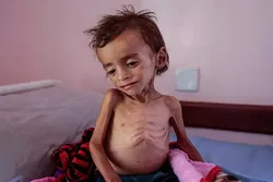 Yemen Most Dangerous Place on Earth for Children: UNICEF Chief