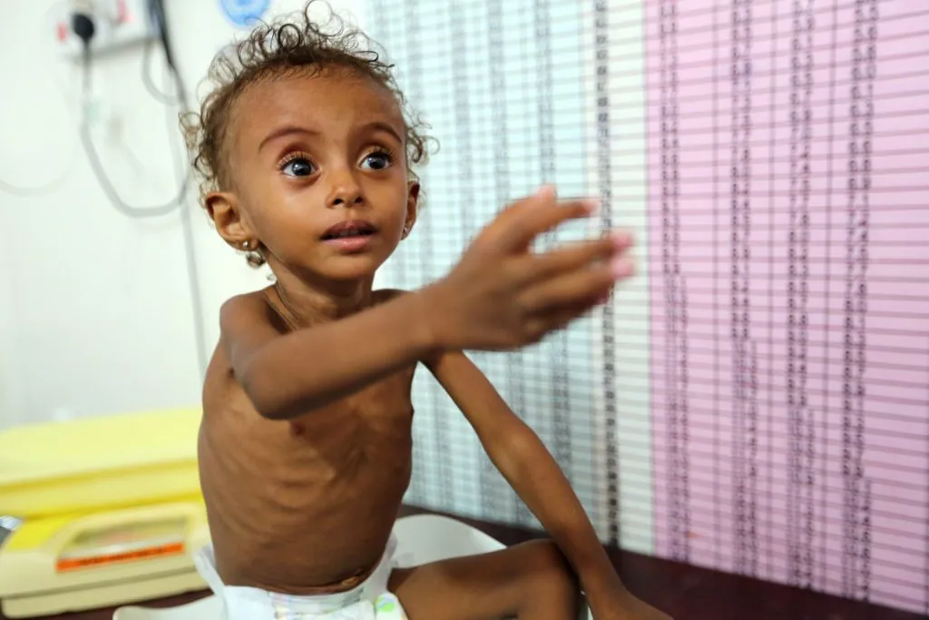 Croce Rossa: milioni di persone in Yemen soffrono di insicurezza alimentare a causa dell’aggressione saudita