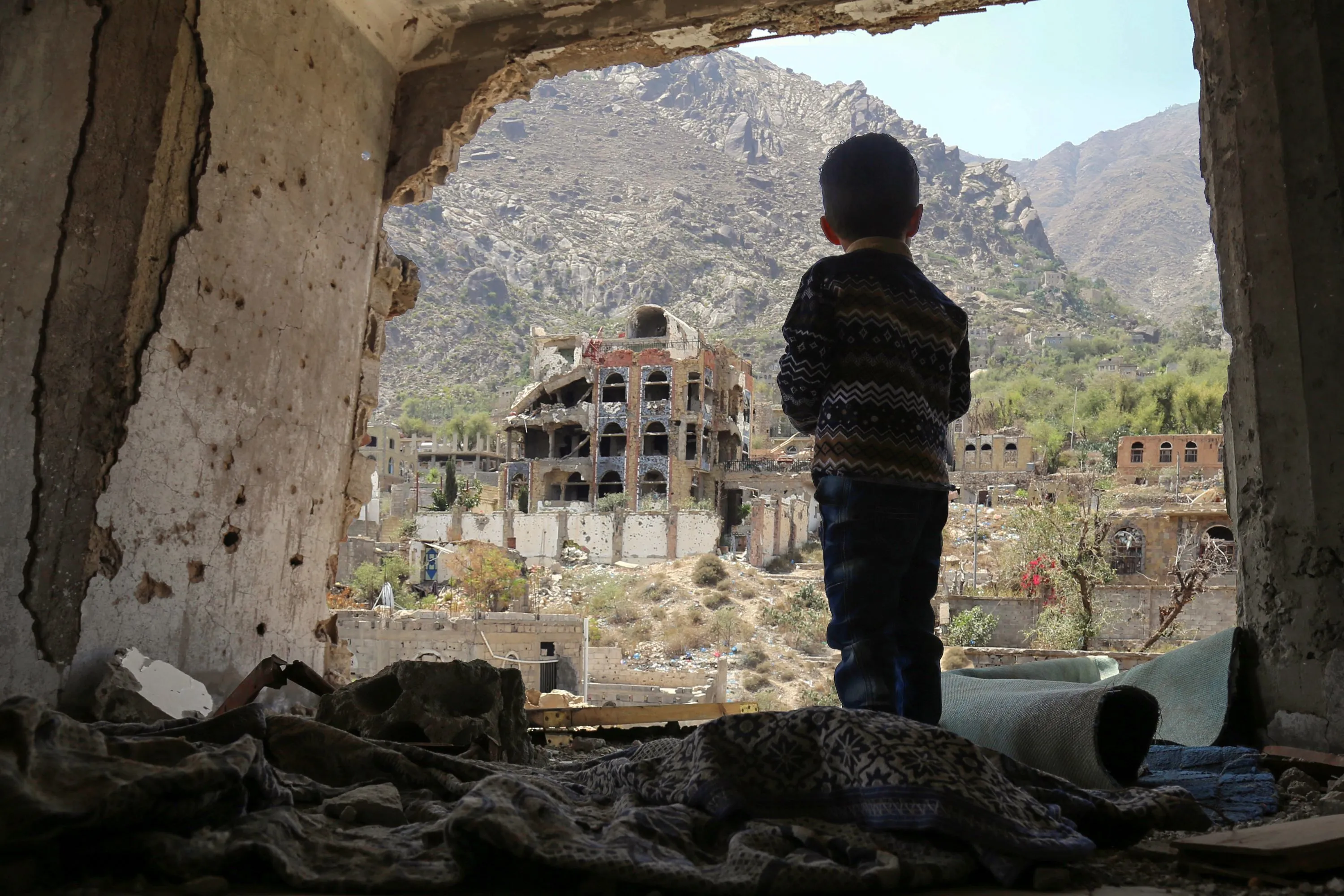 Yemen, 17,8 milioni di persone necessitano di assistenza sanitaria