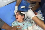 Galeria de fotos: Dezenas de deslocados mortos em ataque aéreo israelense em Rafah