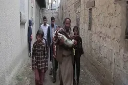 BMT: Yəmən əhalisinin 70 faizi aclıq çəkir