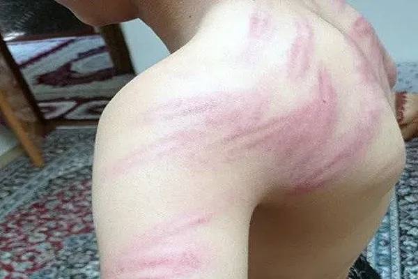 ورود دستگاه قضایی به ضرب و جرح دانش‌آموزان روستای کرجو