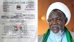Mwili wa Sheikh Zakzaky una vipande 43 vya mabaki ya risasi