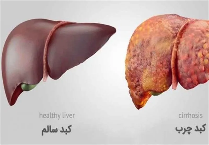 طب سنتی| مهم‌ترین عامل ابتلا به 