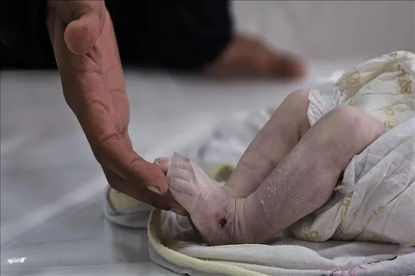 Gaza Tragedy: Another Palestinian Baby Dies of Cold  