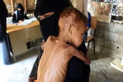 UN: Humanitäre Krise im Jemen muss dringend behandelt werden