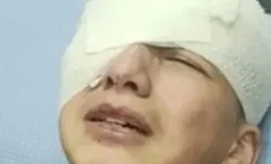 ফিলিস্তিনি শিশুর চোখে গুলি করল ইসরাইলি সেনা