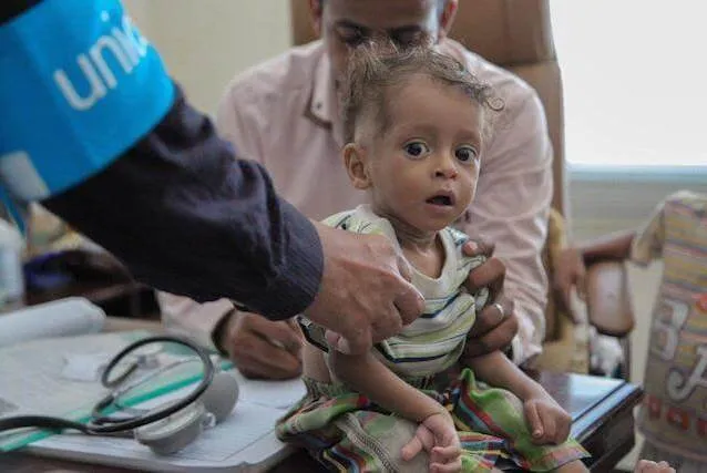 Yemen, il 92% dei bambini nasce sottopeso