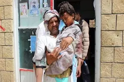 শিশুদের ওপর সৌদির হামলার বিচার চায় জাতিসংঘ কমিটি
