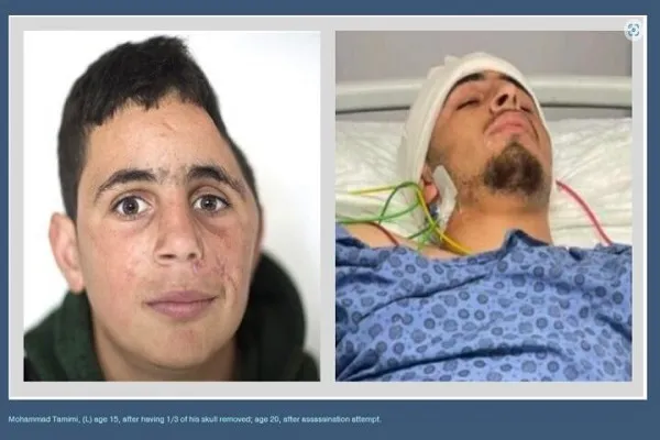 Mohammad Tamimi, il ragazzo sopravvissuto a vari tentativi israeliani di assassinarlo… si rifiuta di morire