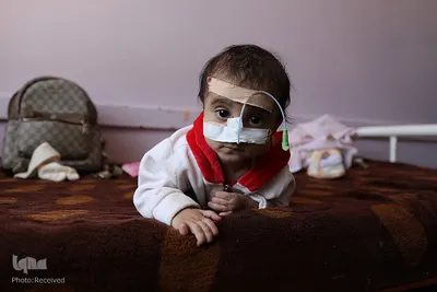 سوءتغذیه کودکان «یمنی» را می کشد