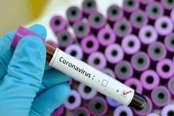 Aden Gouverneur warnt vor VAE Versuchen Coronavirus nach Aden zu transferieren