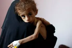 Yemen Could Face 'Catastrophic' Food Situation  