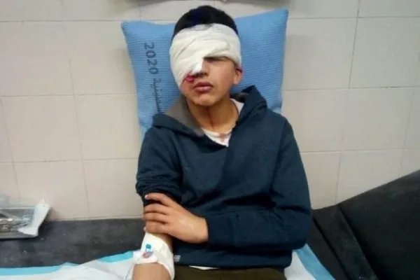 Sionist İsrail qüvvələri fələstinli uşağı vurdu