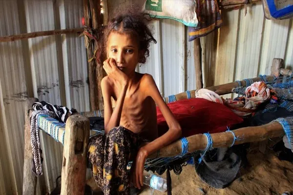 ONU da voz de alarma: Situación en Yemen “nunca ha sido peor”