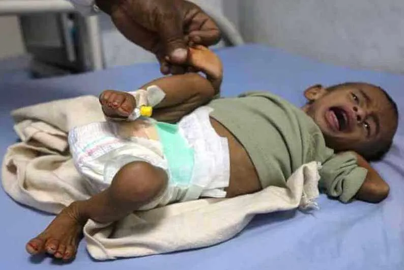 Yemen, oltre 5mila bambini uccisi o feriti nella guerra
