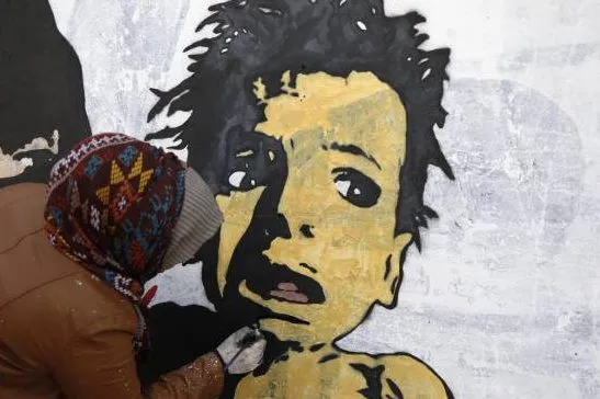 Yemen, missili sauditi causano malformazioni tra i bambini