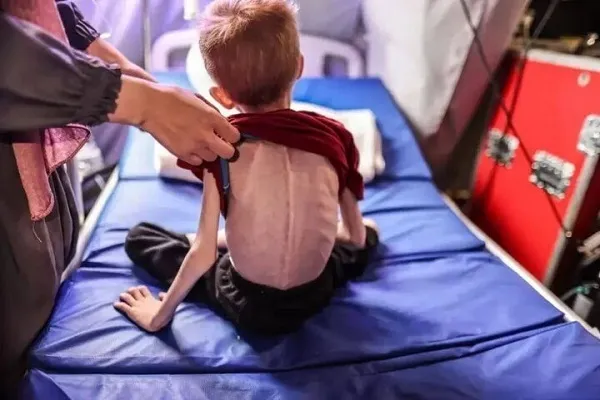 Crise humanitaire à Gaza : l’enfance en détresse face à la famine et au blocus
