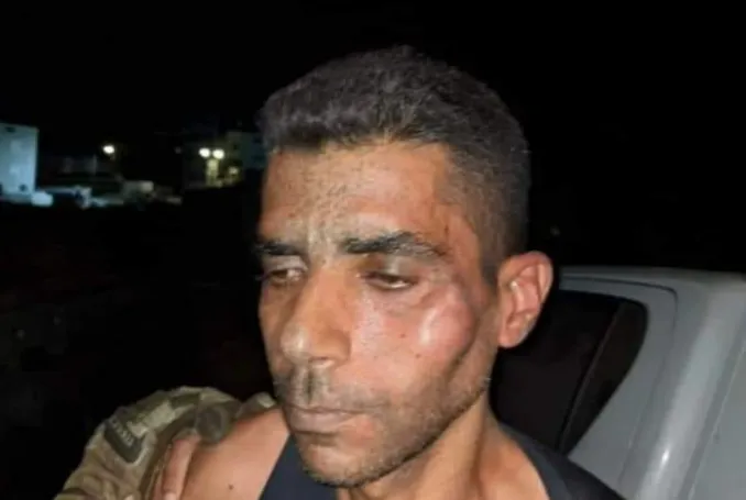 Zakaria Zubeidi hospitalizado tras brutal golpiza por parte de la policía israelí