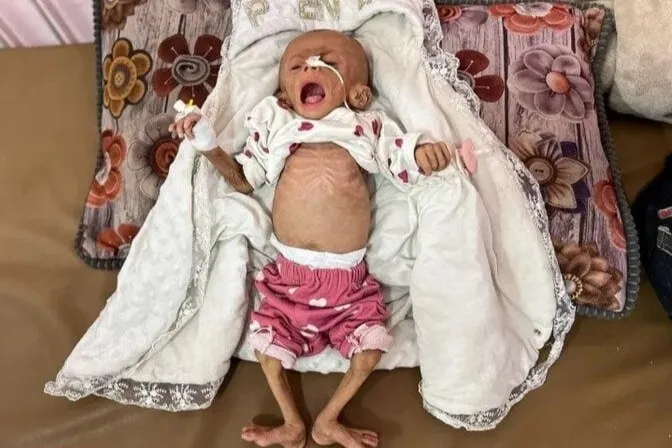 شهادت یک نوزاد دیگر در غزه/ ۱۷ هزار کودک فلسطینی سوءتغذیه دارند